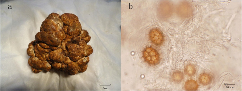 图   攀枝花白块菌子囊果(a)和孢子(b)