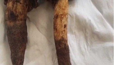 第一波野生菌上市！是時候復(fù)習(xí)“防毒”指南啦→