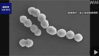 “食人菌”在日本肆虐，食用菌產業是否受到波及？